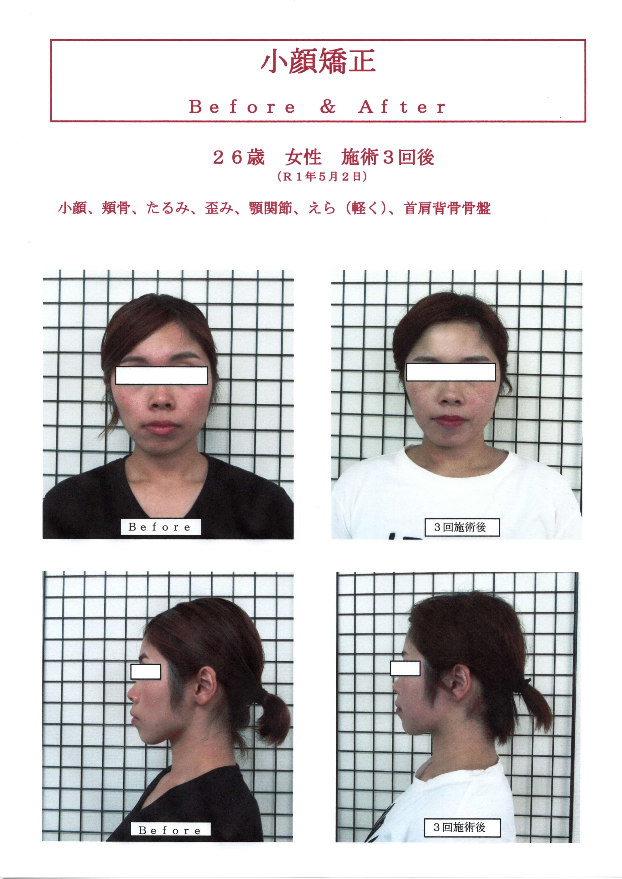 お顔のコンプレックスを解消