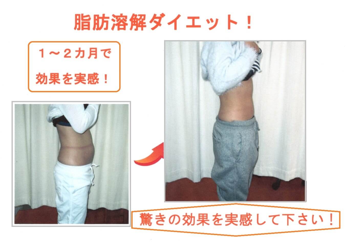 耳つぼダイエット