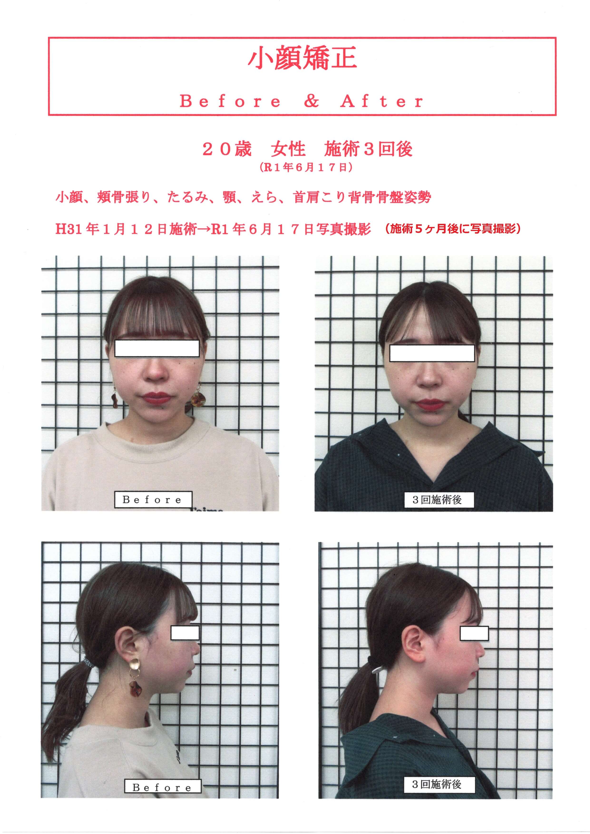 高知で小顔矯正整体院