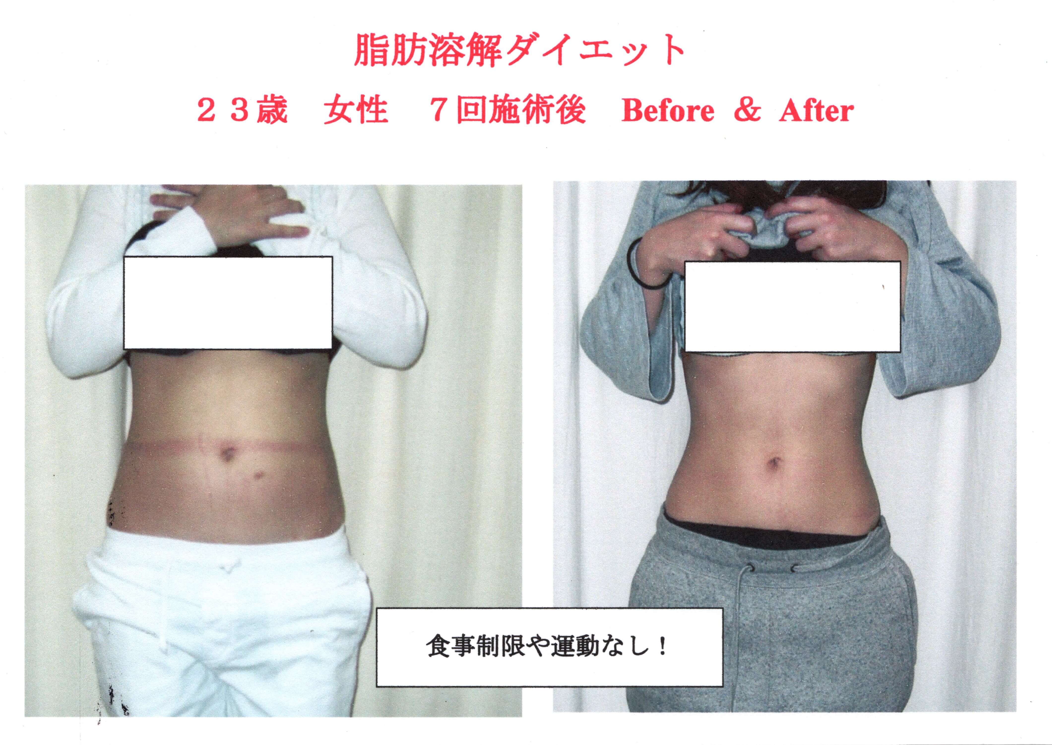 若い女性が太る原因