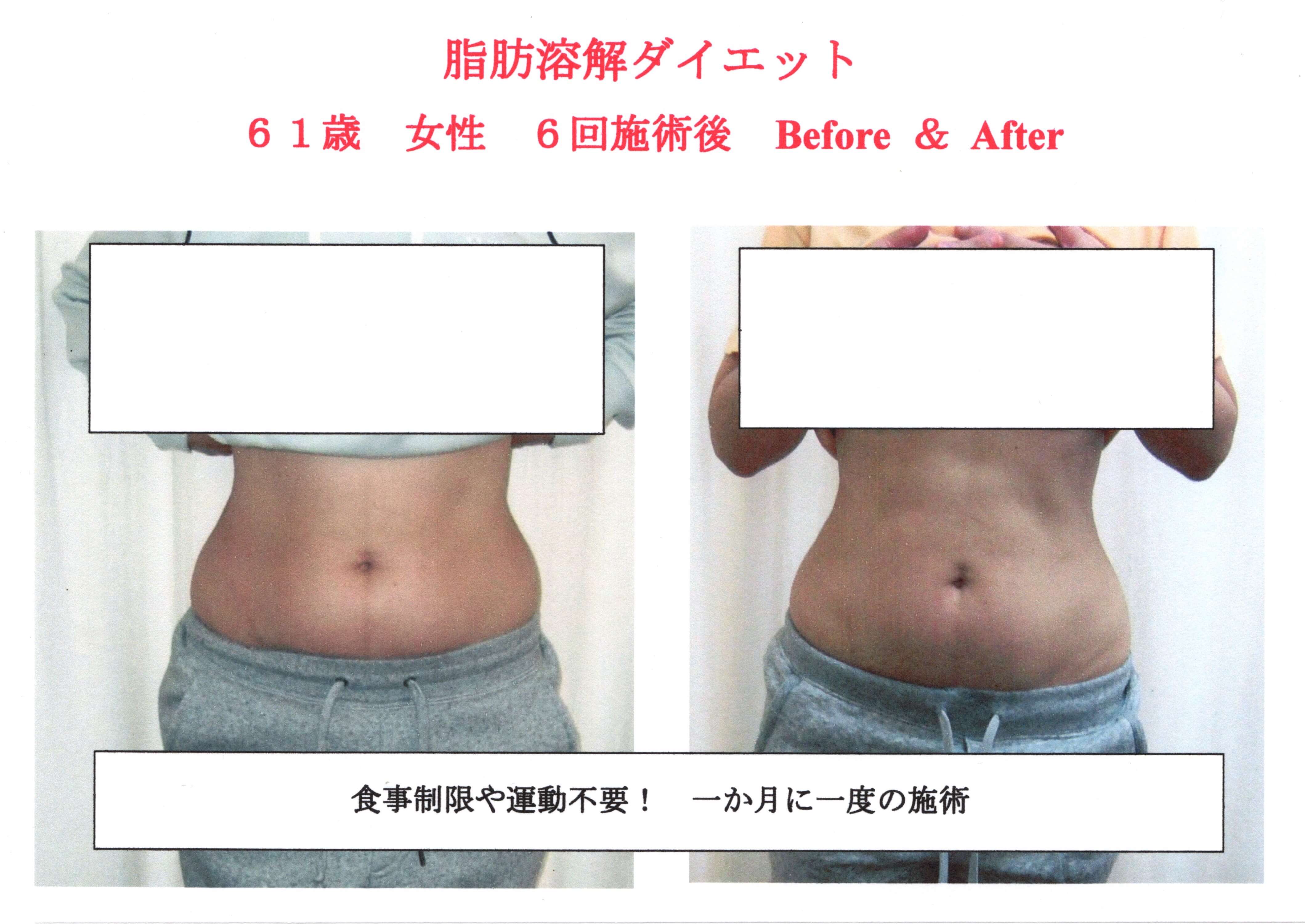 筋肉を付けて基礎代謝アップ