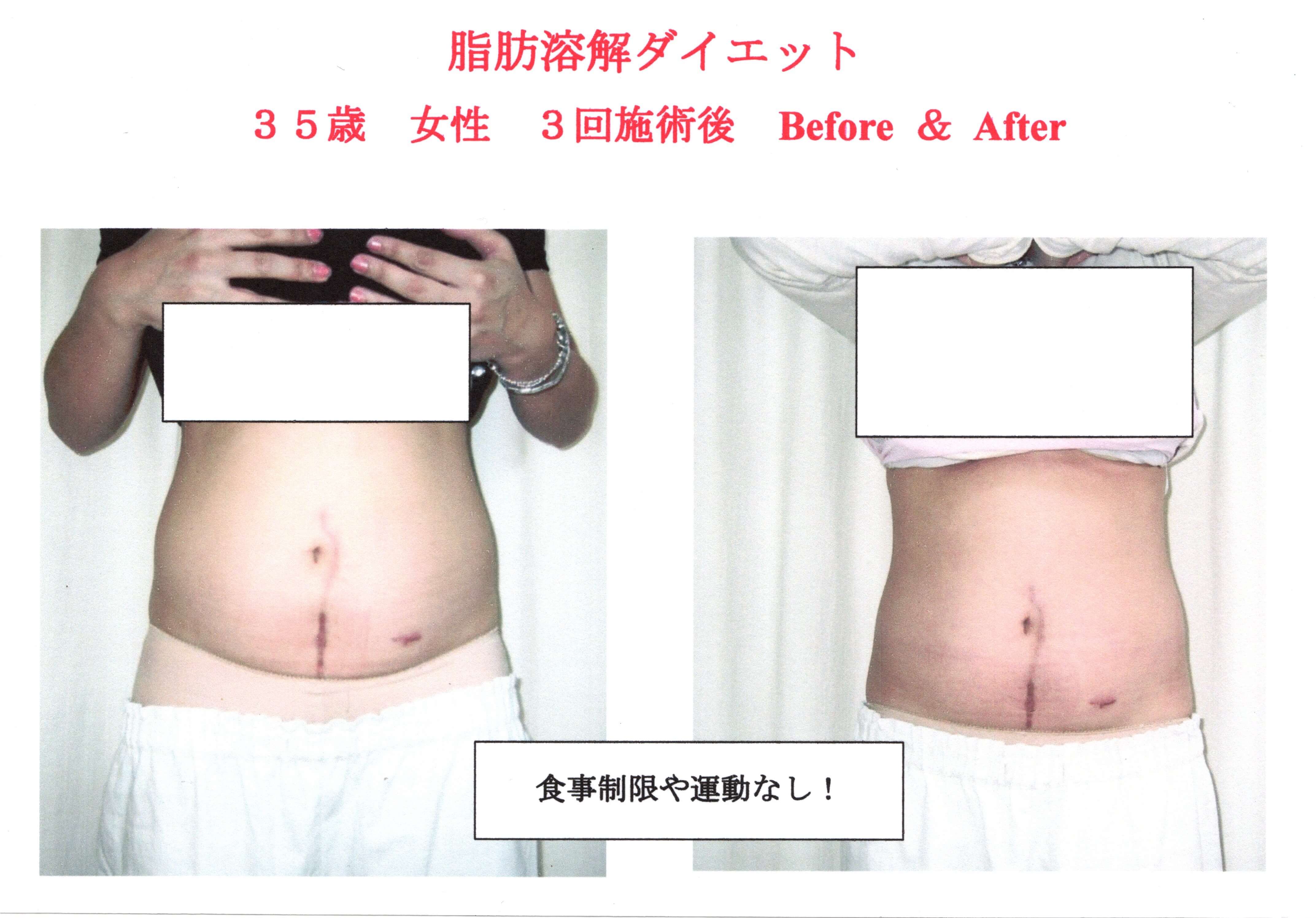 ダイエット中に注意すること