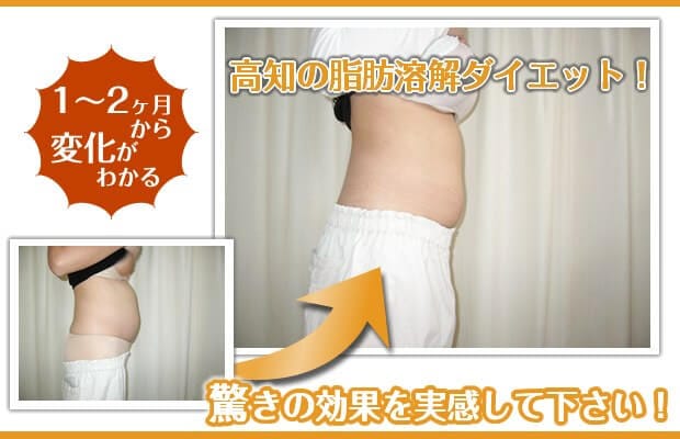 脂肪溶解ダイエット新プラン