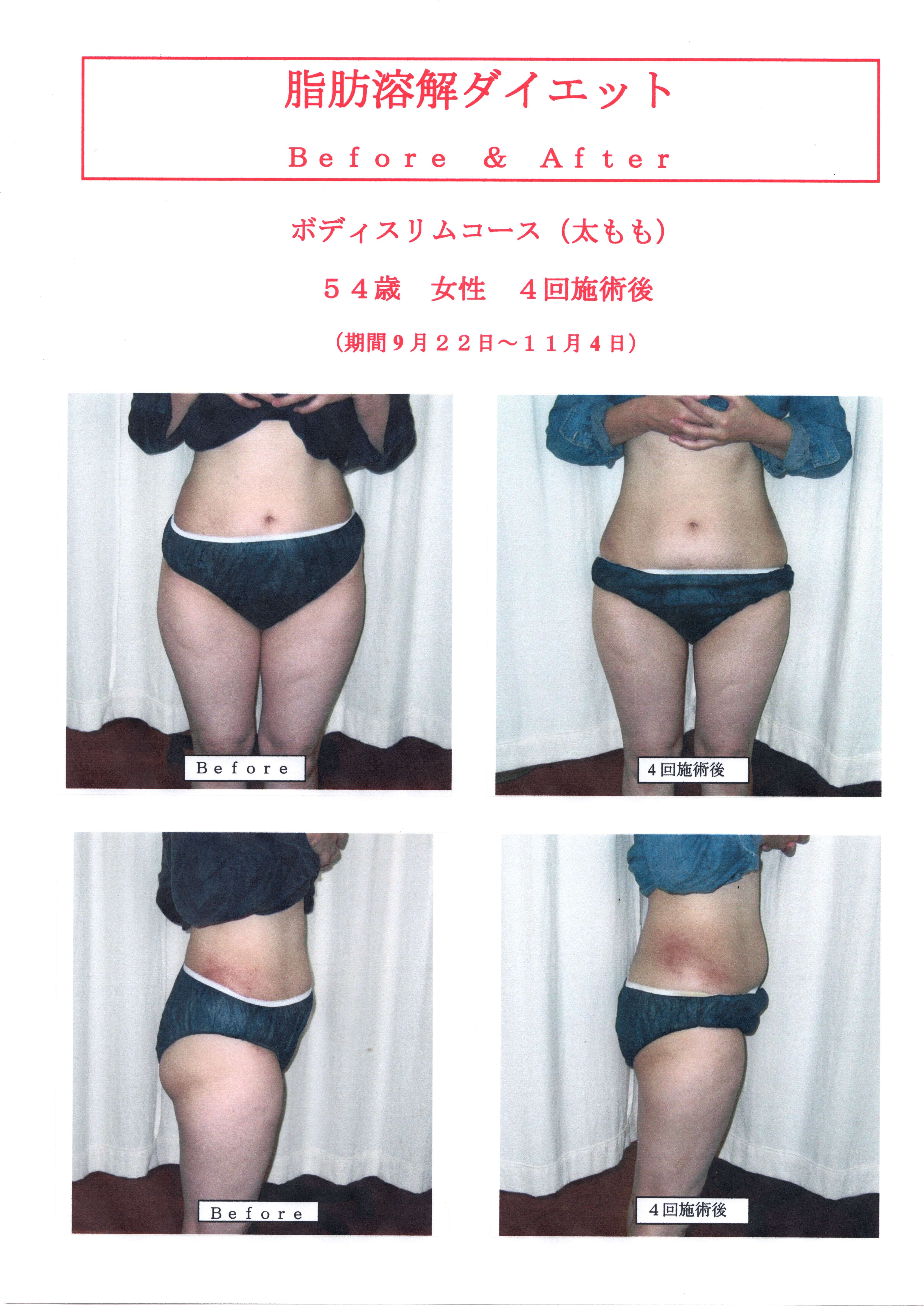 こんな時期だからこそお勧めダイエット