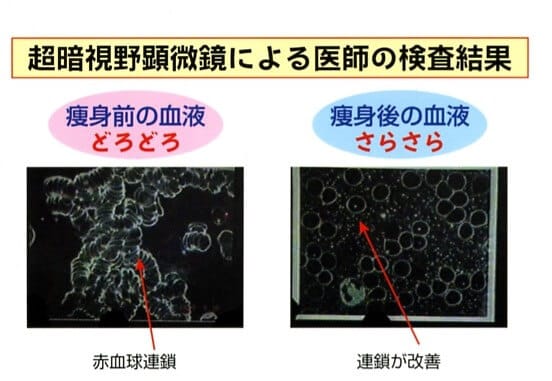 サラサラ血液について