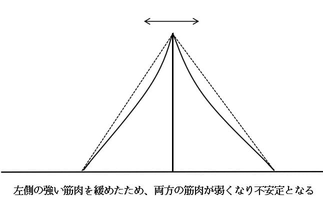 骨が不安定な状態